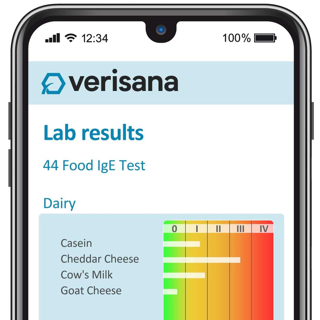 Food Allergy Test 44 Foods B59847